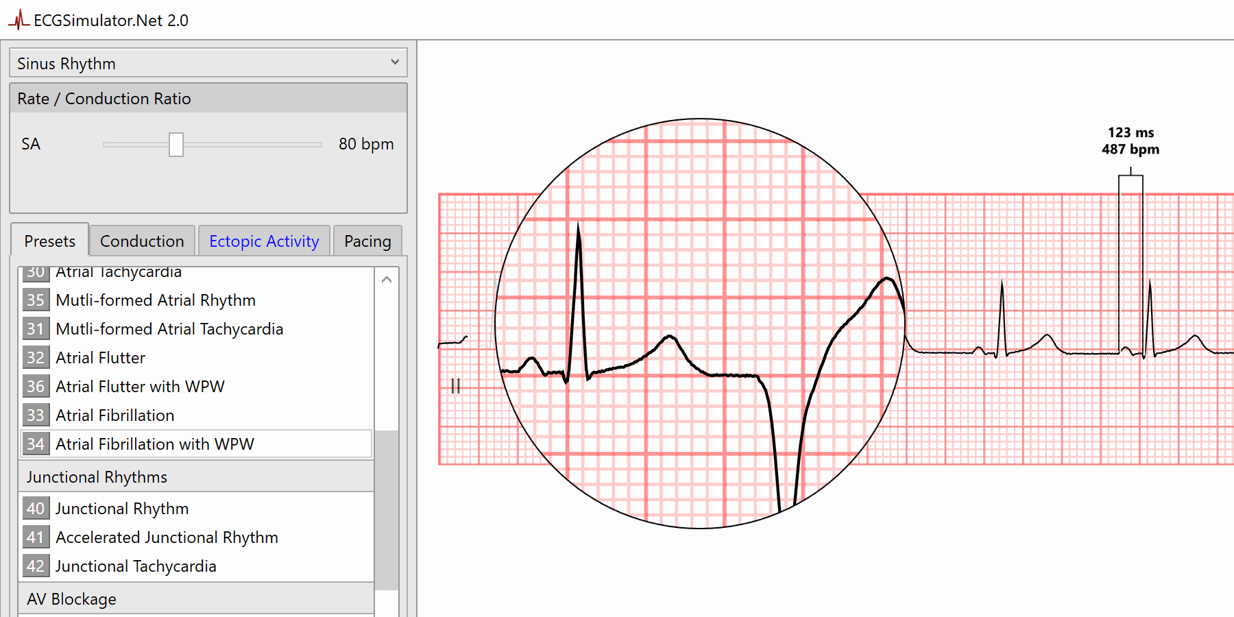 ecg simulator software free download