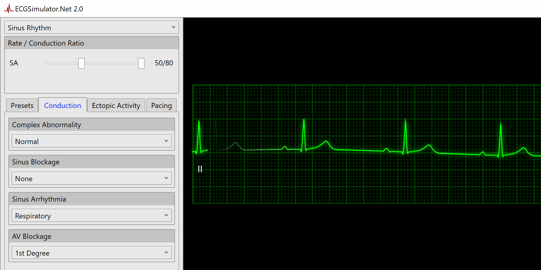 Combine Rhythms