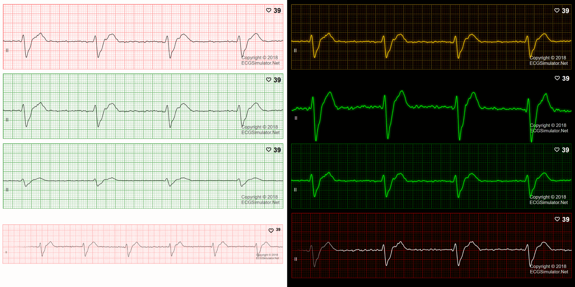 ecg simulator software free download