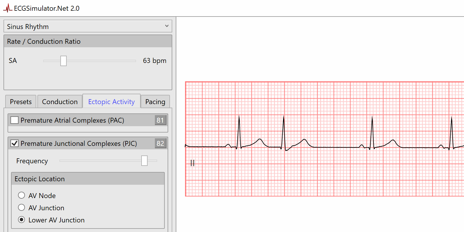 Features Ecgsimulator Net